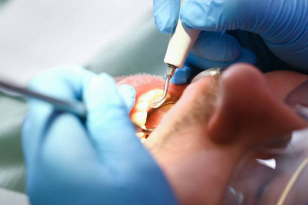 Best Emergency Treatment for Dental Infections or Abscesses in Enterprise, UT