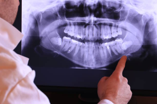 Best Emergency Gum Treatment in Enterprise, UT