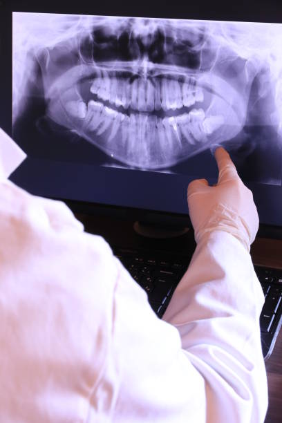 Best Emergency Tooth Extraction in Enterprise, UT