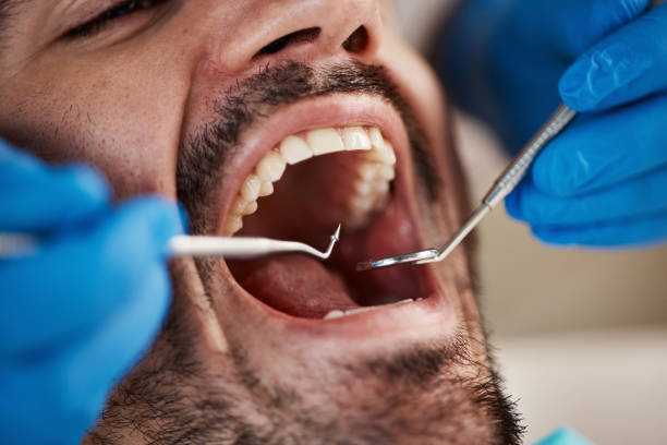 Best Emergency Treatment for Dental Infections or Abscesses in Enterprise, UT