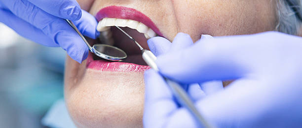 Best Emergency Wisdom Teeth Removal in Enterprise, UT